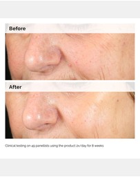 The Ordinary - Alpha Arbutin 2% + HA - 60ml