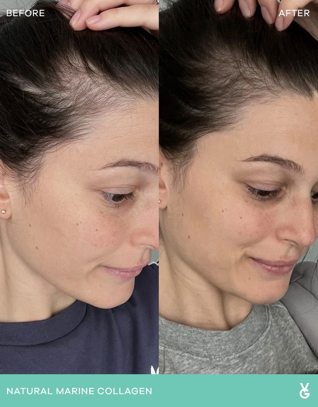 Vida Glow - Mixed Natural Marine Collagen Trial Pack