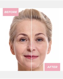 MCoBeauty - Glow Boost Vitamin C Serum 30ml