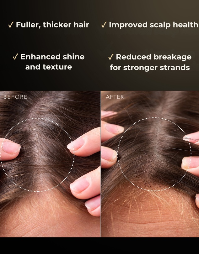 FOREO - Advanced Scalp Revitalising Treatment
