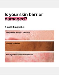 The Ordinary - Soothing & Barrier Support Serum