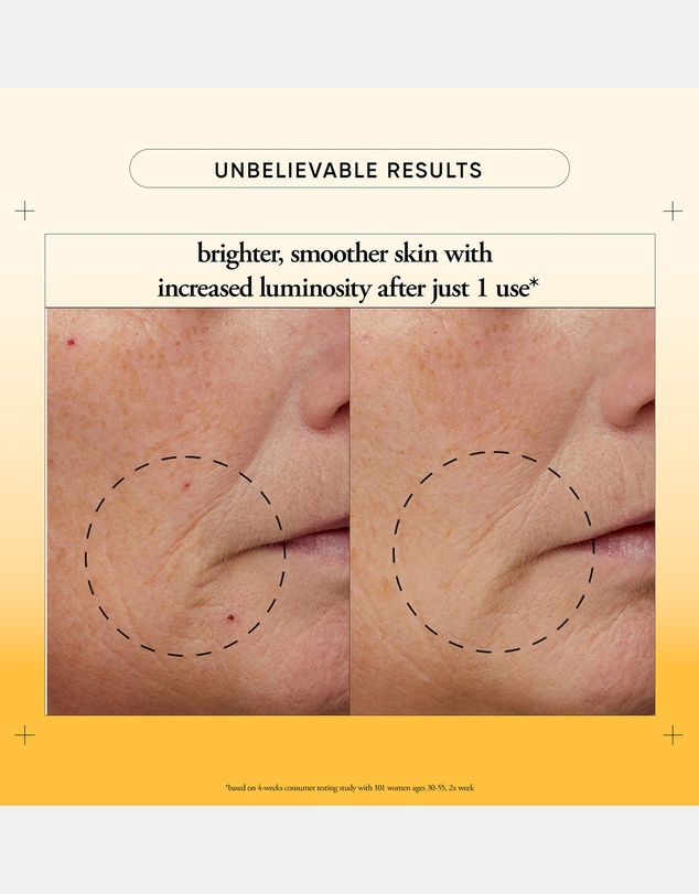 Philosophy - Microdelivery Mini Resurfacing Peel Kit (30ml + 30g)