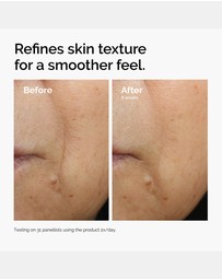 The Ordinary - Caffeine 3% + Escin 1% Face Serum