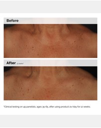 The Ordinary - Niacinamide 5% Face and Body Emulsion