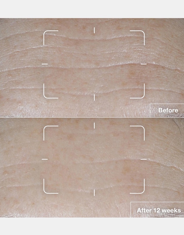 Clinique - Smart Clinical Repair SPF 15 Wrinkle Correcting Cream
