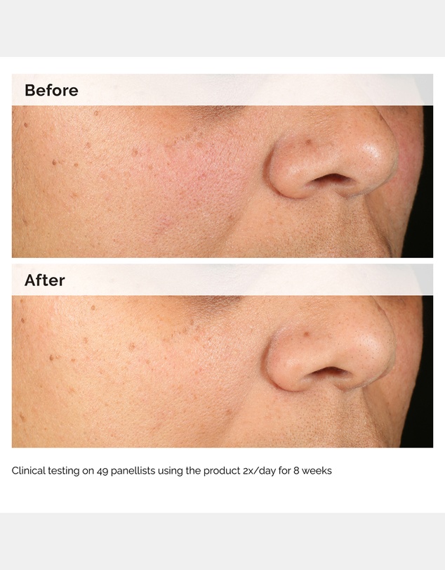 The Ordinary - Alpha Arbutin 2% + HA - 60ml