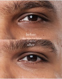 Ere Perez - Grape Water Eye Serum
