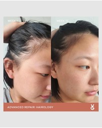 Vida Glow - Hairology™