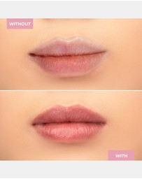 MCoBeauty - Hyaluronic Ultra-Treatment Lip Balm