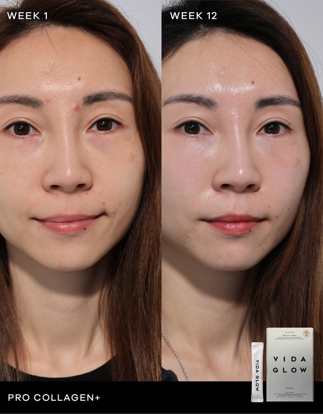 Vida Glow - Pro Collagen+