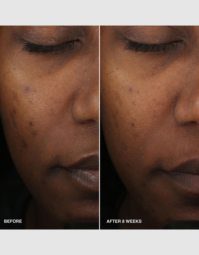 Bobbi Brown - Vitamin Enriched Smoothing Serum