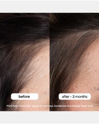 Bondi Boost - Anti-Thinning Procapil® Scalp Tonic