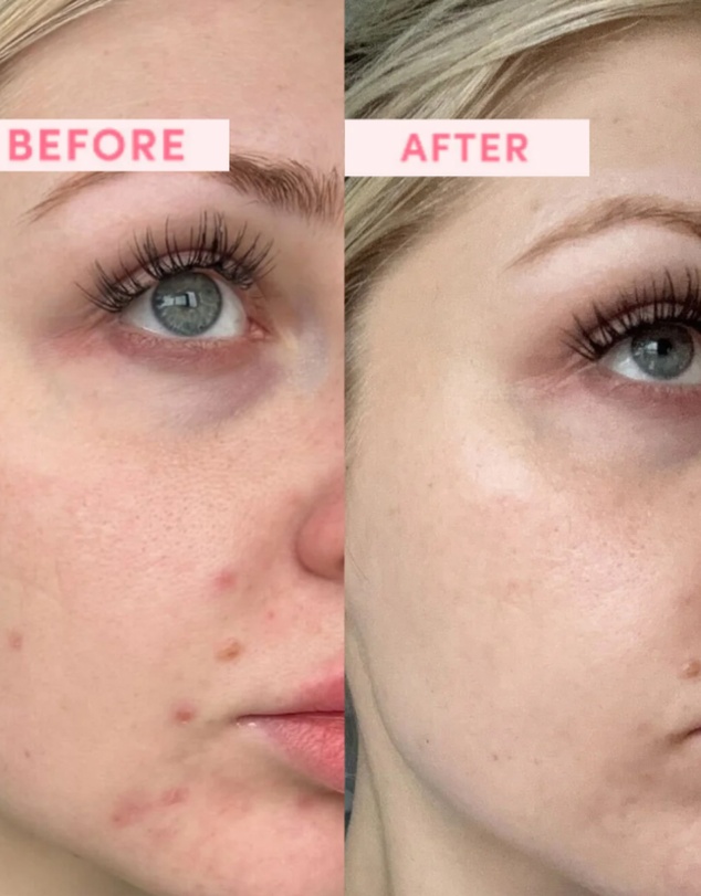 SAND & SKY - Australian Pink Clay Resurfacing Face Mask
