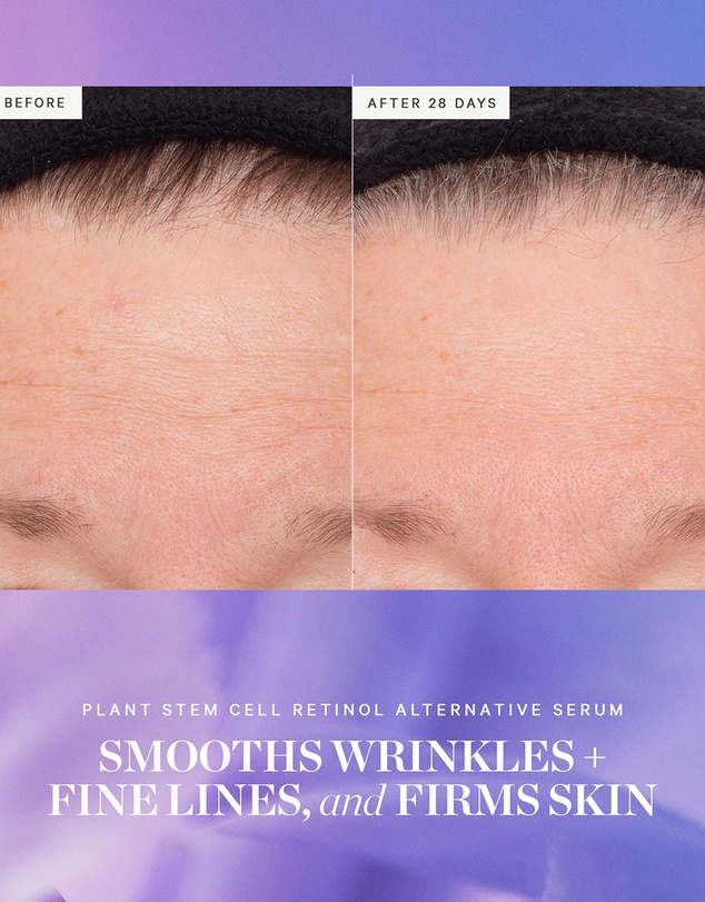KORA Organics - Plant Stem Cell Retinol Alternative Serum