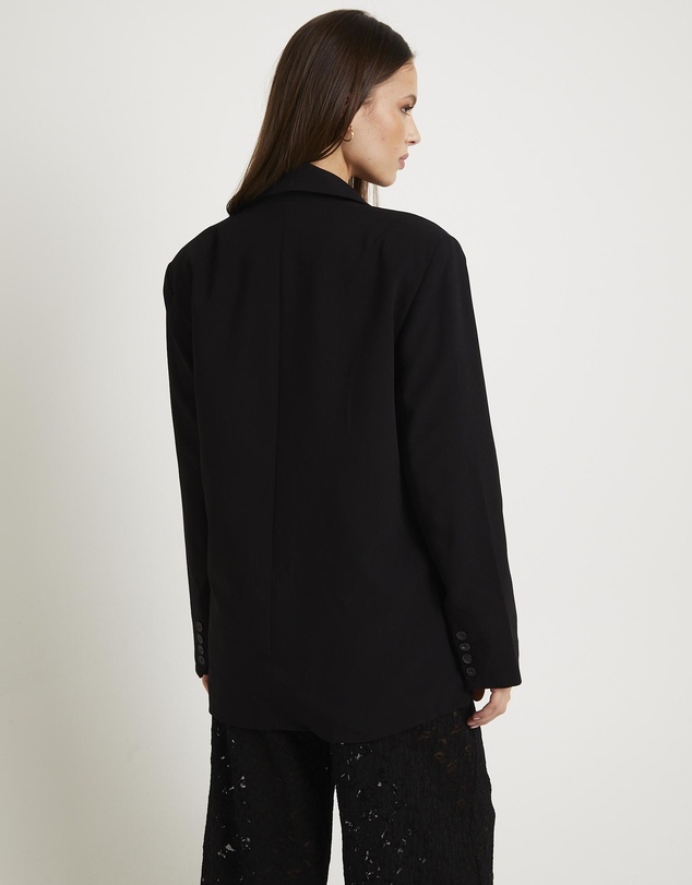 Alice In The Eve - Amiri Oversized Blazer