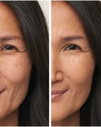 Jane Iredale - Enlighten Plus™ Under-eye Concealer