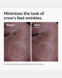 The Ordinary - GF 15% Solution