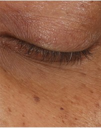 Clinique - All About Eyes Brightening Serum Concentrate