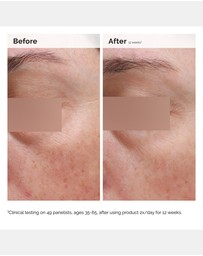 The Ordinary - Niacinamide 5% Face and Body Emulsion