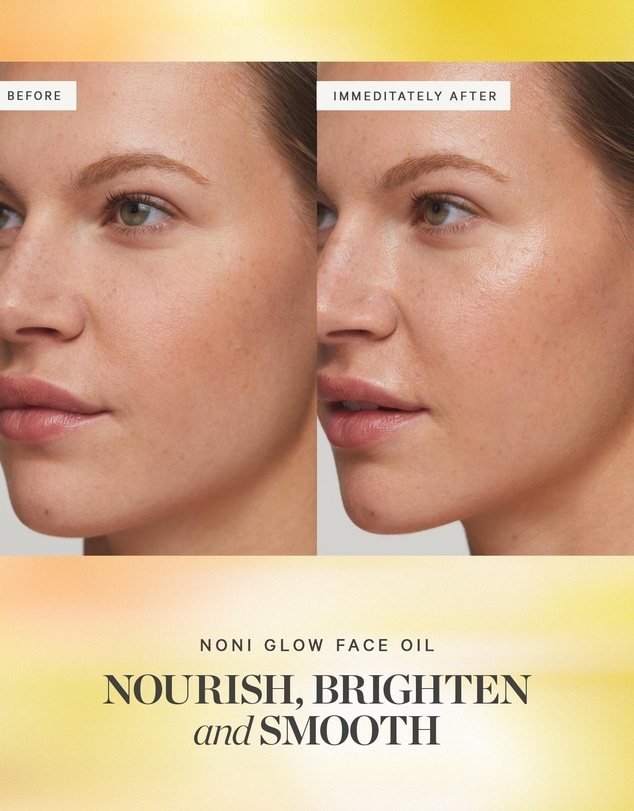 KORA Organics - Noni Glow Face Oil