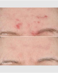 Bobbi Brown - Vitamin Enriched Smoothing Serum