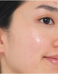 The Ordinary - 100% Plant-Derived Squalane