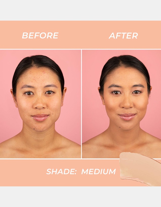 MCoBeauty - Miracle BB Cream - Medium