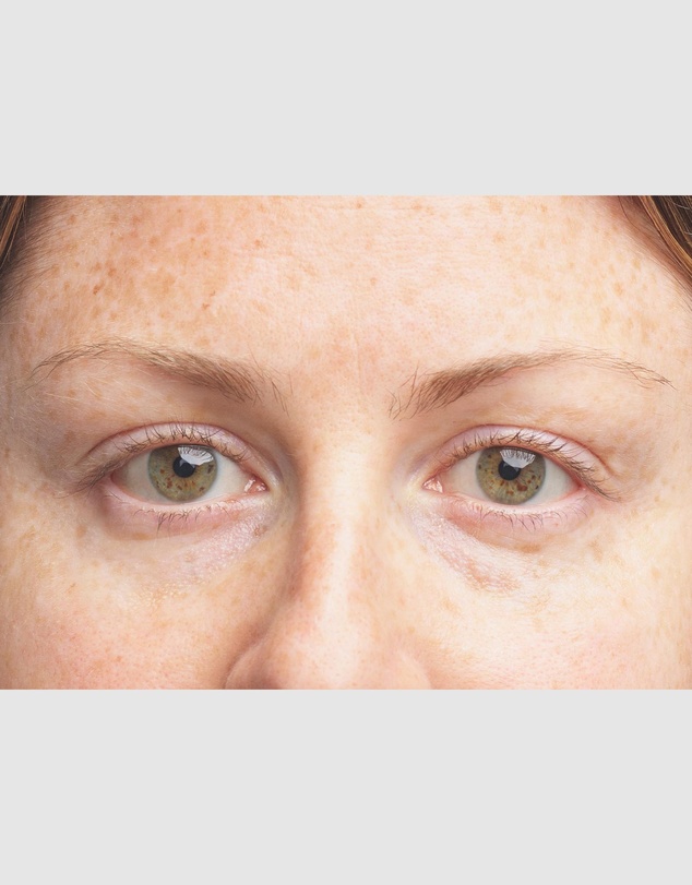 Clinique - All About Eyes Brightening Serum Concentrate