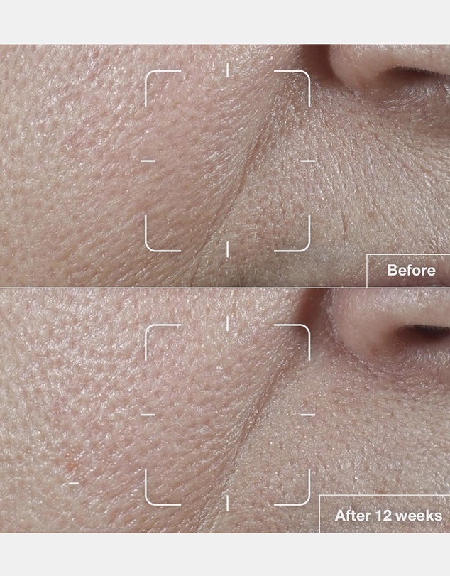 Clinique - Smart Clinical Repair SPF 15 Wrinkle Correcting Cream