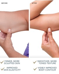 FOREO - Body Contour Therapy