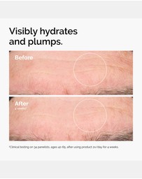 The Ordinary - Hyaluronic Acid 2% + B5