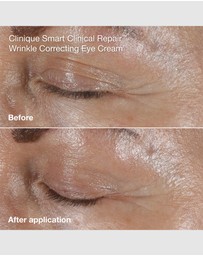 Clinique - Anti-Aging Routine: Mini Smart Clinical Repair Kit