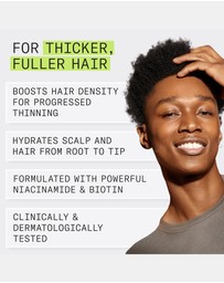 Nioxin - Nioxin System 2 Scalp + Hair Conditioner - Hair Thickening Conditioner For Natural Hair With Progressed Thinning 300ml