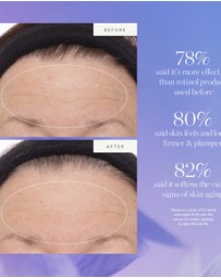 KORA Organics - Plant Stem Cell Retinol Alternative Serum