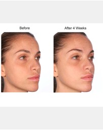 Elizabeth Arden - Elizabeth Arden Visible Brightening Clearly Radiant Spot Correcting Capsules, 60 piece