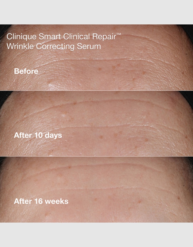 Clinique - Anti-Aging Routine: Mini Smart Clinical Repair Kit