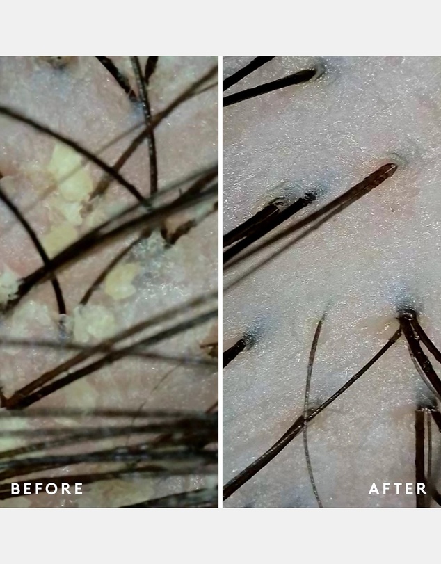 Virtue Labs - Scalp Remedy Conditioner