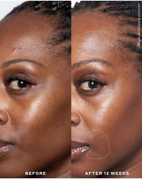 Ole Henriksen - Double Rewind 0.3% Pro-Grade Retinol Serum