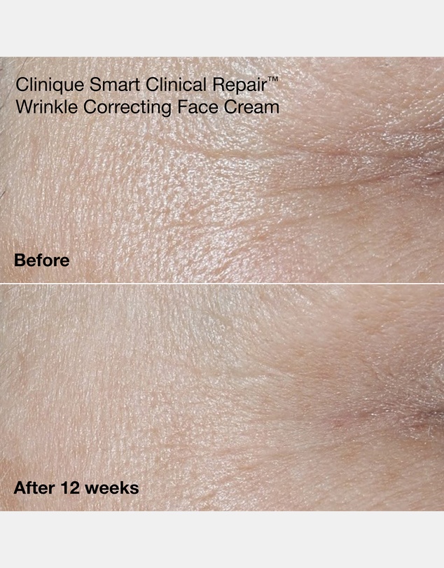 Clinique - Clinique Smart Clinical Repair™ Wrinkle Correcting Rich Cream