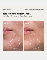 The Ordinary - Sulfur 10% Powder-to-Cream Concentrate
