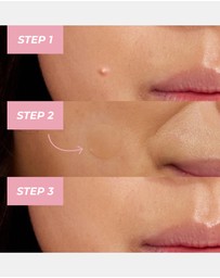 MCoBeauty - Miracle Pimple Patches