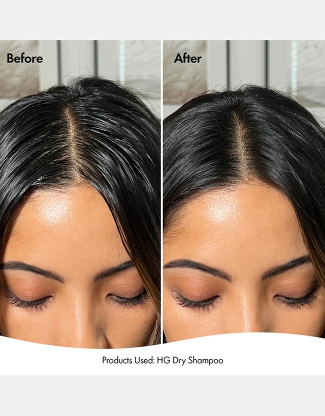 Bondi Boost - Hair Growth Dry Shampoo