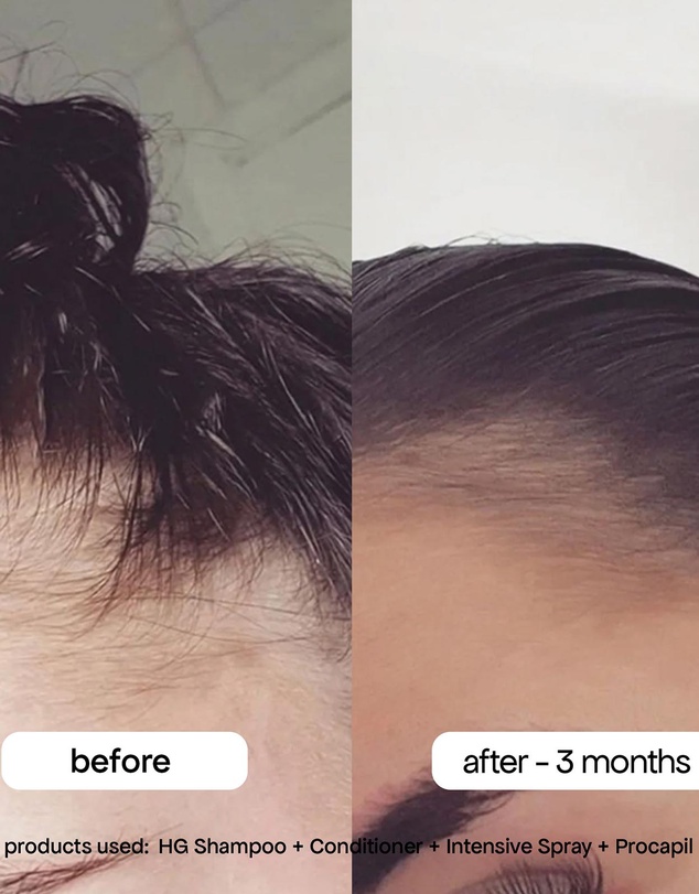 Bondi Boost - Anti-Thinning Procapil® Scalp Tonic