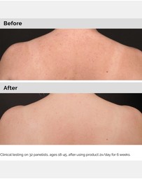 The Ordinary - Salicylic Acid 0.5% Body Serum