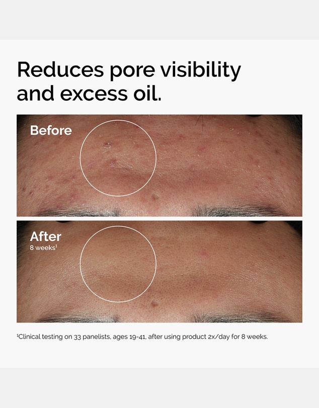 The Ordinary - Niacinamide 10% + Zinc 1% 60ml