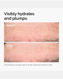 The Ordinary - Hyaluronic Acid 2% + B5