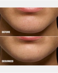 Benefit Cosmetics - POREfessional Degunker