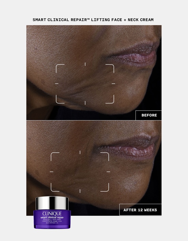 Clinique - Smart Clinical Repair Lifting Face + Neck Cream
