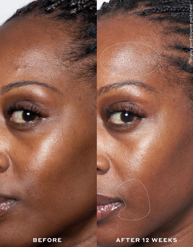 Ole Henriksen - Double Rewind 0.3% Pro-Grade Retinol Serum
