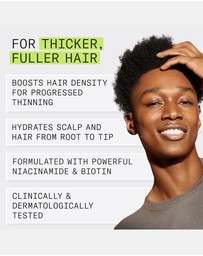 Nioxin - Nioxin System 2 Scalp + Hair Shampoo - Hair Thickening Shampoo For Natural Hair With Progressed Thinning, 300ml